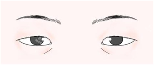 三角眼 三角眼