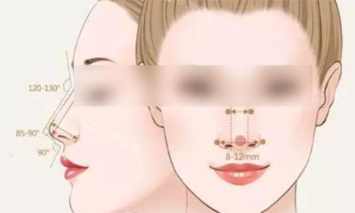 隆鼻标准对比