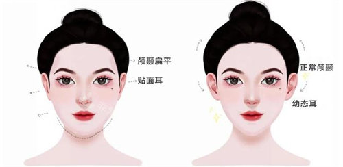 幼态脸主要做的项目