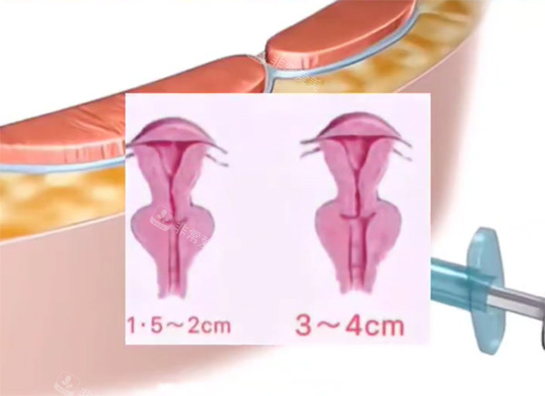 紧缩针对比动画