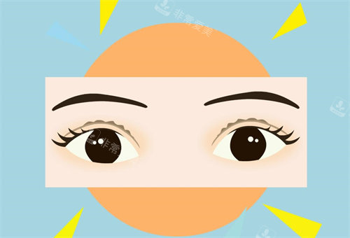 韩国男士双眼皮手术做的怎么样?我选择了一家我爱豆去的整形外科，感觉术后真的很自然!