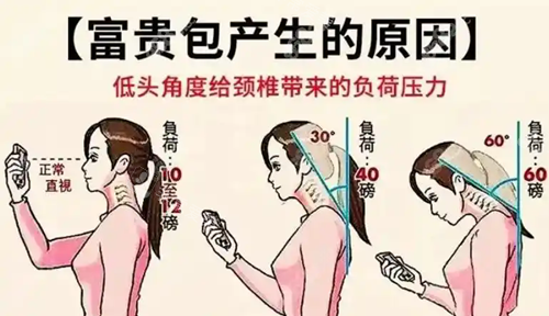 景德镇治疗富贵包的医院哪家好?亚菲医疗美容|圣嘉丽整形|艺美整形做富贵包手术出名!
