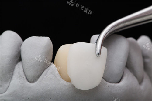 树脂贴面成品