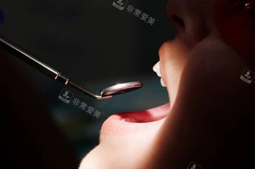 牙齿检查展示图