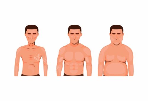 男性乳房发育吸脂后图片示意图