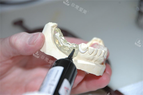 牙齿修复示意图宣传