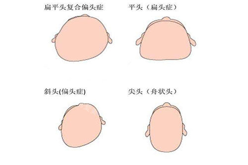 各種頭型卡通圖 各種頭型卡通圖
