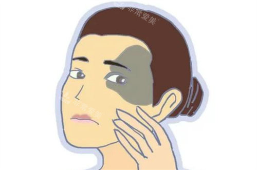 太田痣 太田痣