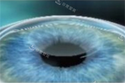 全飞秒透镜