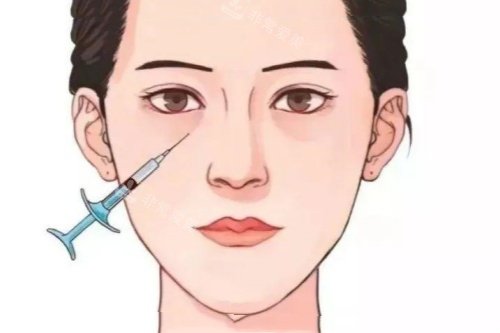 眼部注射卡通图 眼部注射卡通图