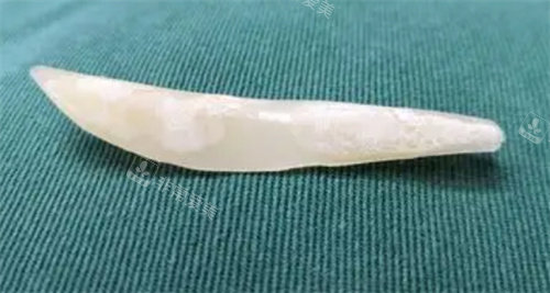 隆鼻假体图片