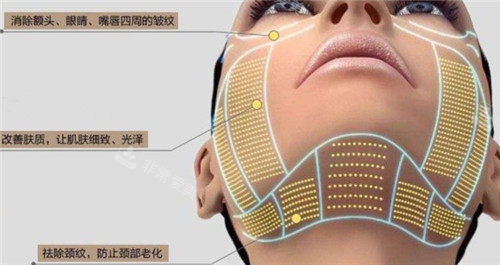 熱瑪吉皮膚作用細(xì)節(jié)圖 熱瑪吉皮膚作用細(xì)節(jié)圖