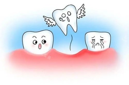 牙齿脱落示意图