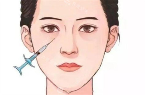 淚溝注射 淚溝注射