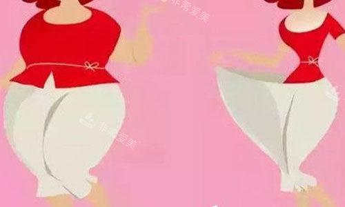 大腿吸脂前后對比圖