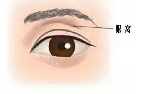 眼窝的示意图 眼窝的示意图