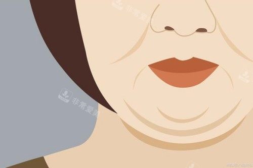 双下巴