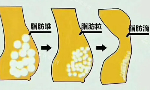 脂肪型胸部脂肪展示 脂肪型胸部脂肪展示