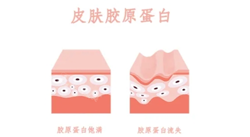 在韩国皮肤科做眼下胶原蛋白注射经验分享！一扫疲惫又衰老的眼部状态