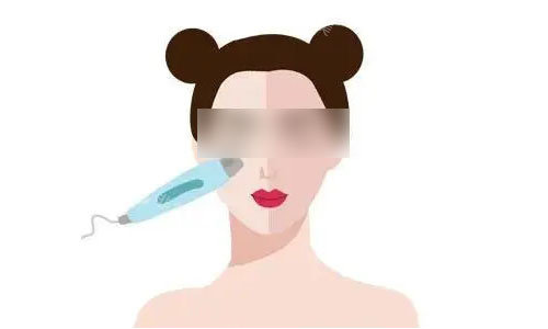 光子嫩肤流程图 光子嫩肤流程图