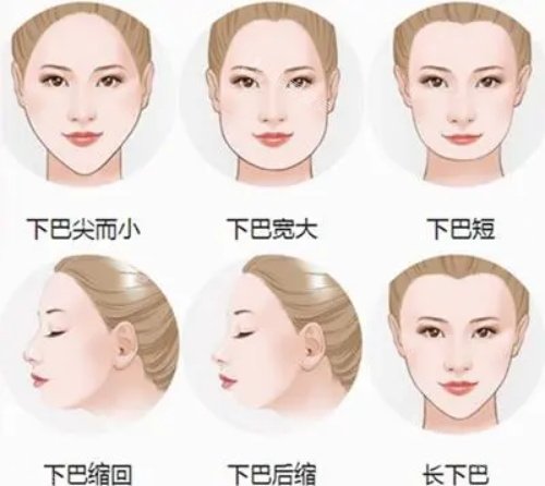 下巴的類型 下巴的類型
