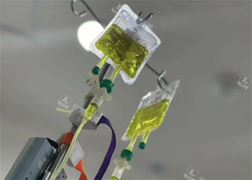 注射大蒜针 注射大蒜针