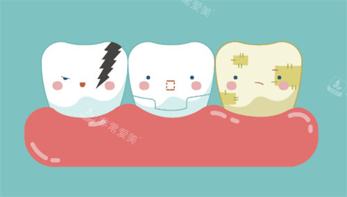 牙齿美白对比卡通图