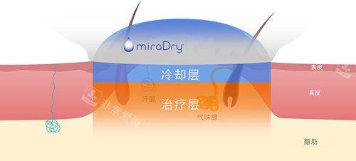清新微波 清新微波