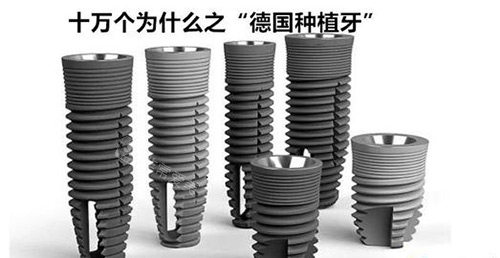 德国种植牙