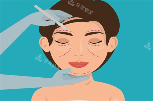 面部提升卡通图