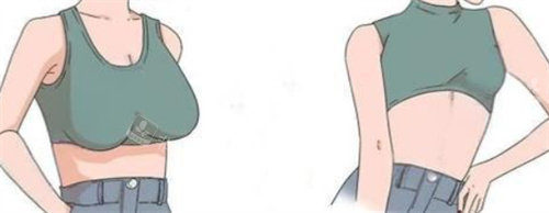 巨乳缩小