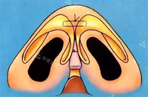 鼻头透视动画展示图