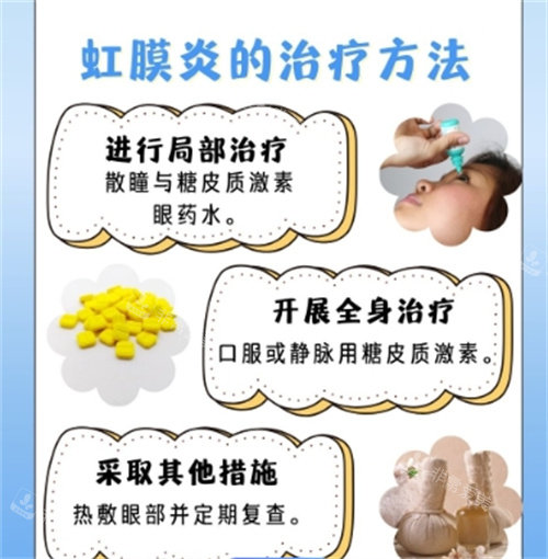 虹膜炎的治疗方法细节图