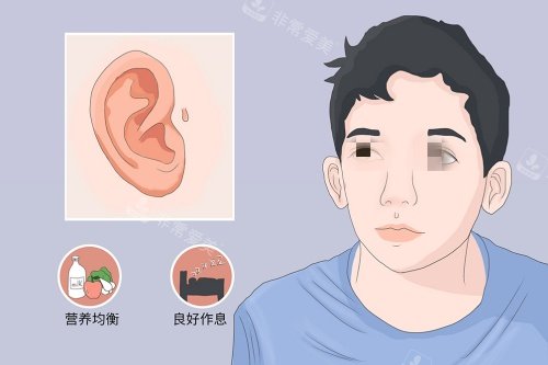 副耳漫画示意图 副耳漫画示意图
