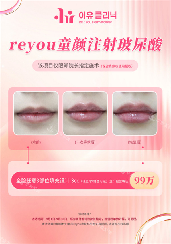 韩国Reyou皮肤科活动价格表图示 韩国Reyou皮肤科活动价格表图示