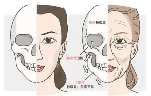 年轻和老化的面部骨骼