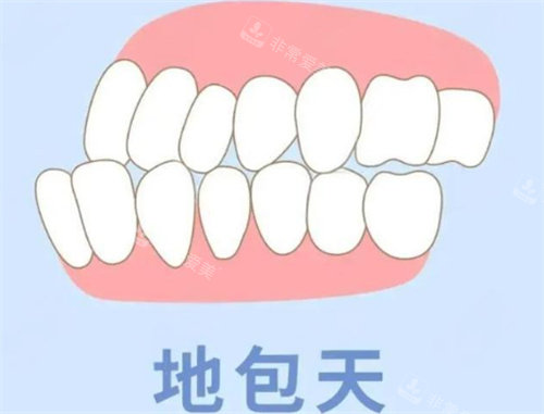 地包天动画展示图