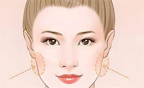 面部两侧凹陷 面部两侧凹陷