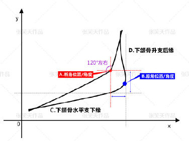 北京圣嘉新医疗美容医院张笑天下颌角手术设计 北京圣嘉新医疗美容医院张笑天下颌角手术设计