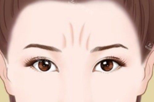 川字紋卡通圖 川字紋卡通圖