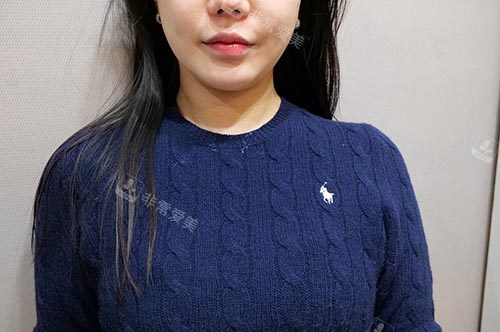 钛提升+韩版<span style=