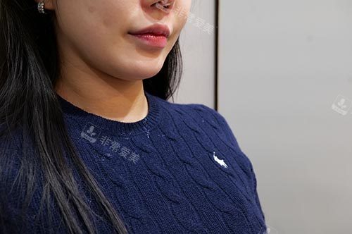 钛提升+韩版<span style=