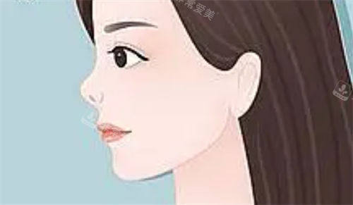 朝天鼻侧面动画展示图