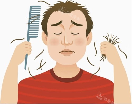 脱发示意图 脱发示意图