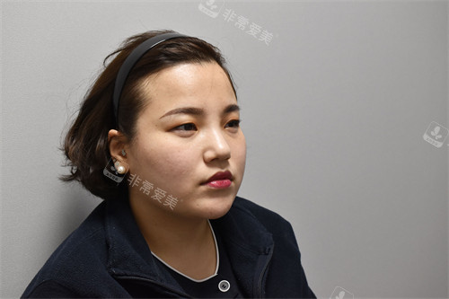 韩国弘大凯特皮肤科轮廓提升前