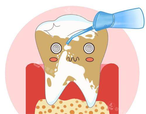 洗牙的动漫示意图