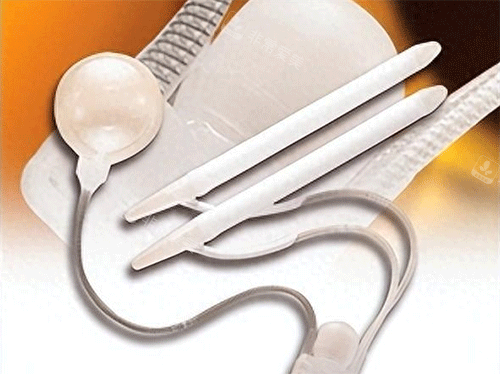 男性阴茎假体植入手术