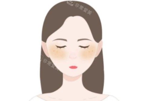 皮肤暗沉发黄卡通图