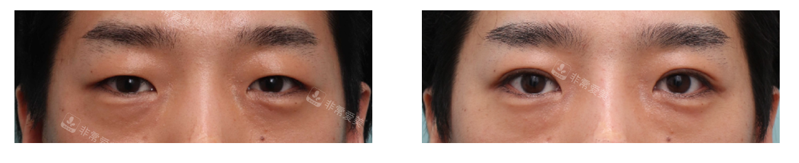 韩国丽尔丽整形外科