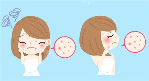 油皮、干皮、敏感肌必看！韩国护肤流程+产品清单，照着做不踩雷！